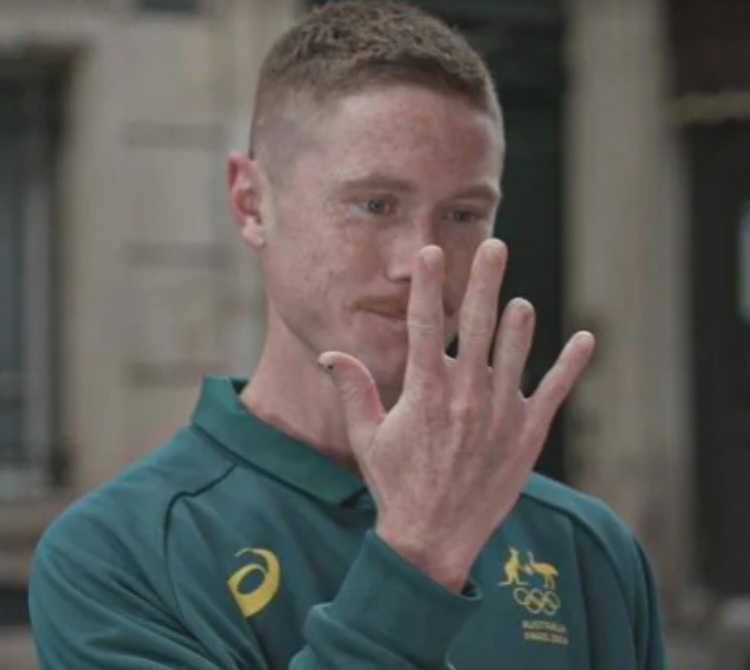 Olympic athlete amputates his finger so he can play in 2024 Paris Games